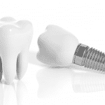 Implants